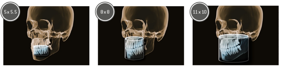 Дентальный томограф Orthophos SL 3D (11x10).jpg