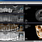 HDX Dentri 3D Classic - компьютерный томограф 2 в 1, FOV 16x8 см фото № 3