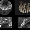 CS9000 3D - Томограф стоматологический с цефалостатом фото № 4
