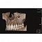KaVo Pan eXam Plus 3D - Томограф стоматологический 6x8 см фото № 6