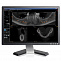 CS9000 3D - Томограф стоматологический с цефалостатом фото № 3