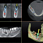 I-Max TOUCH 3D - конусно-лучевой дентальный томограф фото № 3