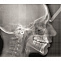 KaVo Pan eXam Plus 3D - Томограф стоматологический 6x8 см фото № 5