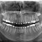 Veraviewepocs 2D - Панорамный рентгеновский аппарат, модель CP 1760 фото № 3