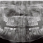 I-Max TOUCH 3D Ceph - конусно-лучевой дентальный томограф c цефалостатом фото № 5