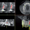 I-Max TOUCH 3D - конусно-лучевой дентальный томограф фото № 4