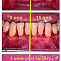 CHEESE DEN 10C - лазер стоматологический четырехчастотный  фото № 4