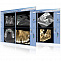 ProMax 3Ds - Томограф стоматологический фото № 4