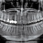 NewTom 2D/3D GO - Томограф стоматологический 10x10 фото № 5