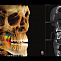 Pax-i 3D SC - Томограф стоматологический с цефалостатом, FOV 17x15 см фото № 4