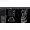 I-Max TOUCH Ceph - панорамный рентген аппарат с цефалостатом фото № 5