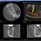 CS9000 3D - Томограф стоматологический с цефалостатом фото № 5